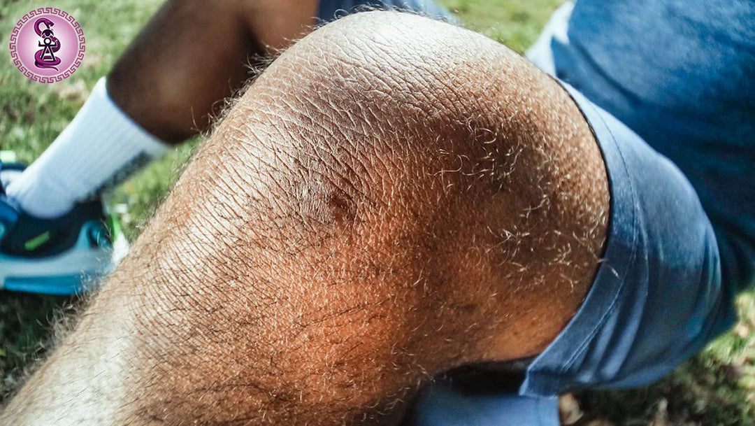 ¿Dónde duele el menisco? Aprende a identificar y tratar su lesión