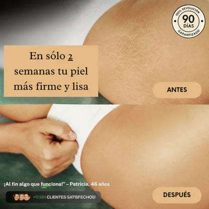 "Por fin algo que funciona" – testimonio real sobre el Aceite Masajeador Anticelulítico