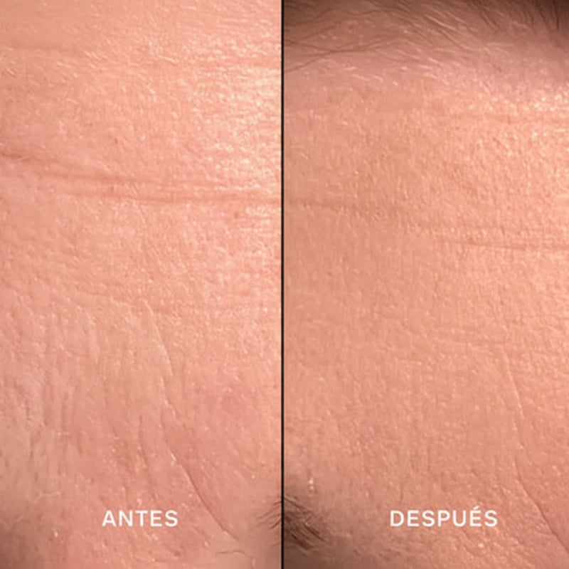 Resultados visibles en semanas