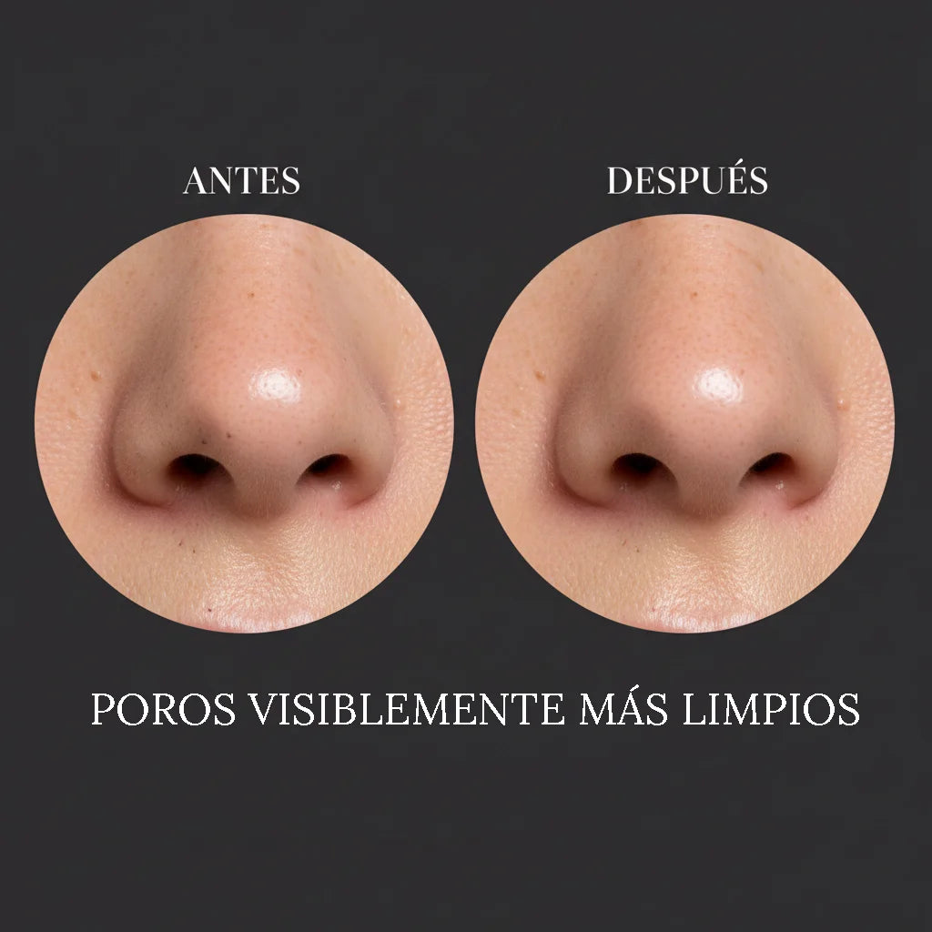 Resultados antes y después mixsoon Glass Skin - Poros visiblemente más limpios