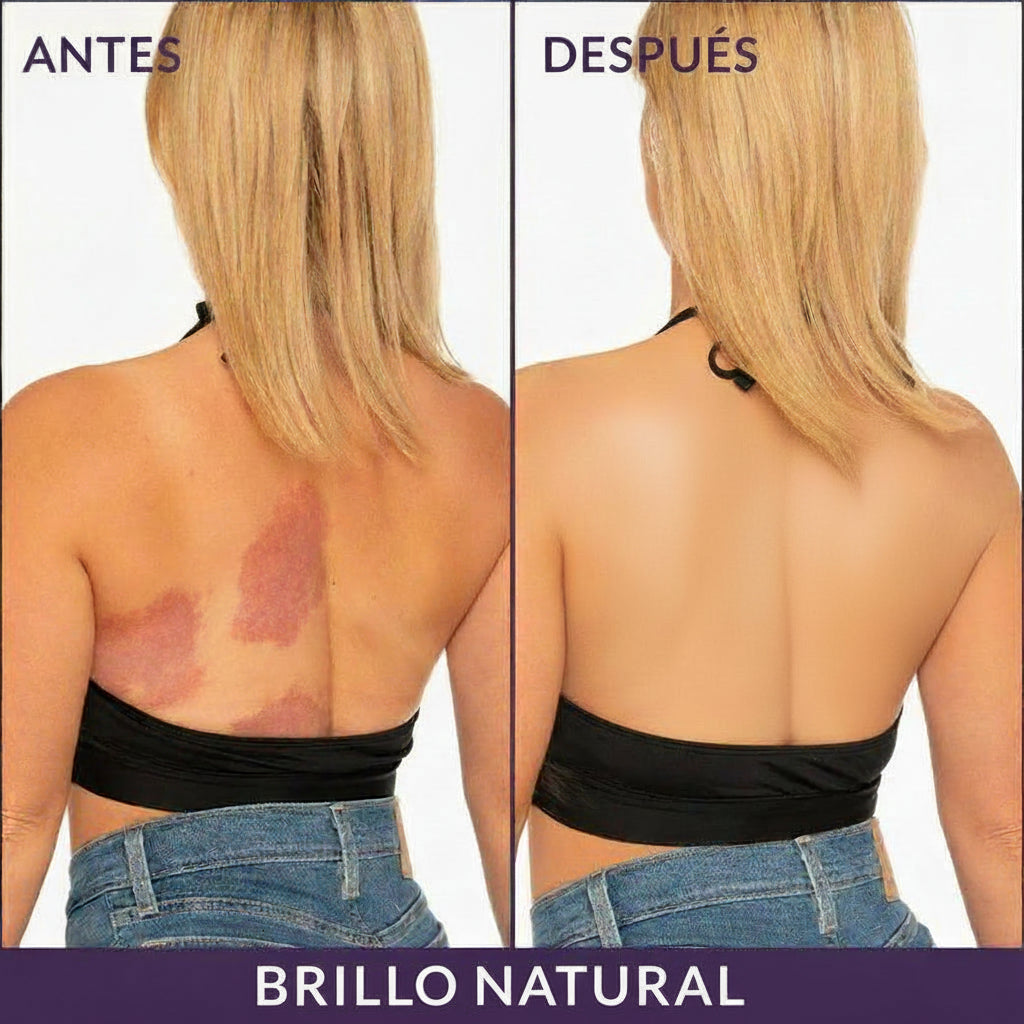 Cobertura de manchas en piel con Westmore Beauty Body Coverage Perfector - comparativa antes y después, tono Natural Radiance